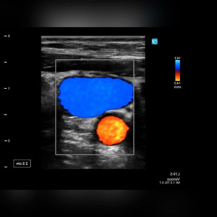 On-Platform Ultrasound System 5