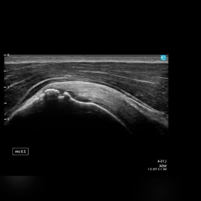 On-Platform Ultrasound System 6