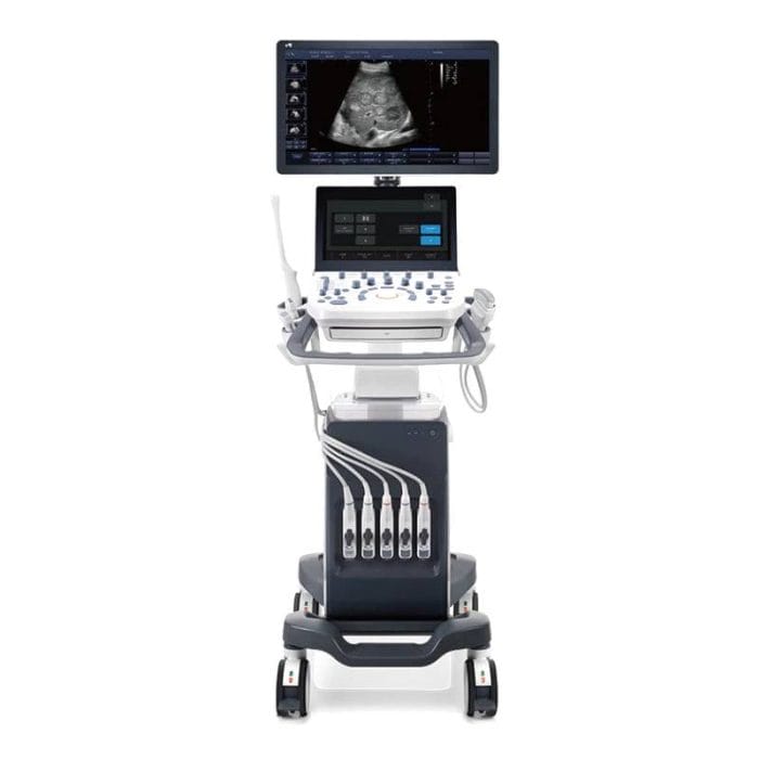 On-Platform Ultrasound System