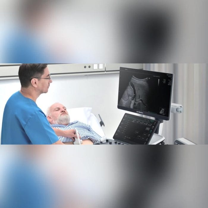 On-Platform Ultrasound System 1