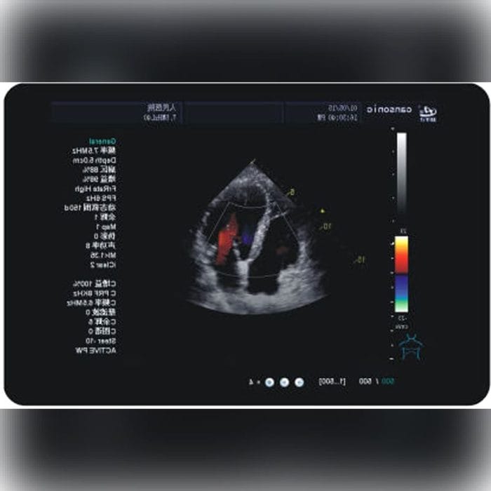 On-Platform Ultrasound System 2