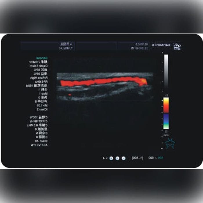 On-Platform Ultrasound System 3