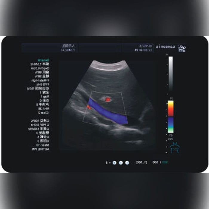 On-Platform Ultrasound System 4