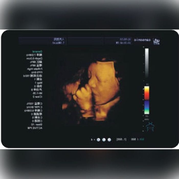 On-Platform Ultrasound System 5