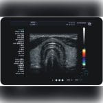 On-Platform Ultrasound System 6