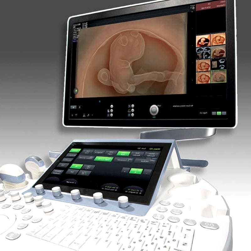 On-Platform Ultrasound System 1