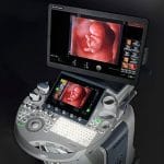 On-Platform Ultrasound System 4