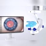 Ophthalmic Examination Microscope 3