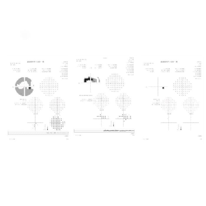 Ophthalmic Perimeter 1