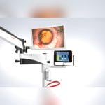 Ophthalmic Surgery Microscope 5