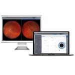 Ophthalmic Surgery Software 1