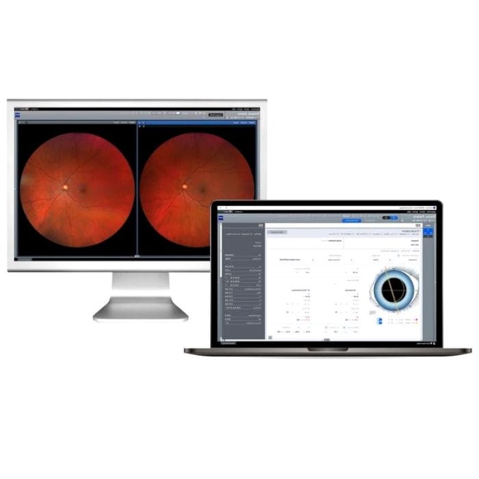 Ophthalmic Surgery Software 1