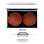 Ophthalmic Surgery Software 2