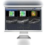 Ophthalmic Surgery Software 4