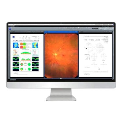 Ophthalmic Surgery Software