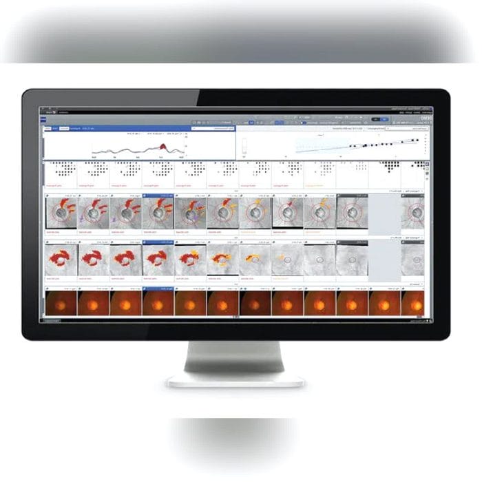 Ophthalmic Surgery Software 5