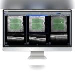 Ophthalmic Surgery Software 7