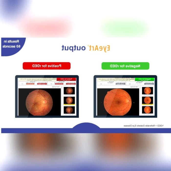 Ophthalmology Software 1