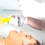 Oral And Nasal Endotracheal Tube 2