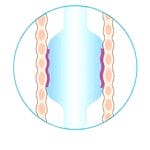 Oral And Nasal Endotracheal Tube 6