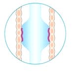 Oral And Nasal Endotracheal Tube 7