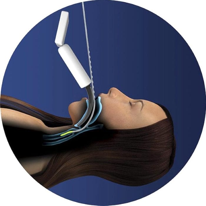 Oral Guide For Endotracheal Tube 3