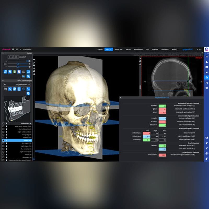 Orthodontic Software