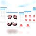 Orthodontic Software 1