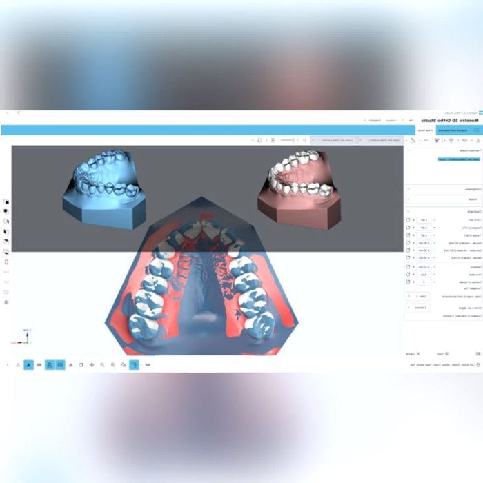 Orthodontic Software 3