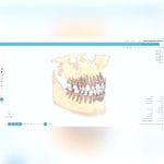 Orthodontic Software 6