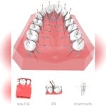 Orthodontic Software 7