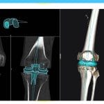 Orthopedic Software 2