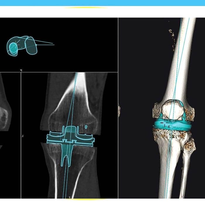 Orthopedic Software 2