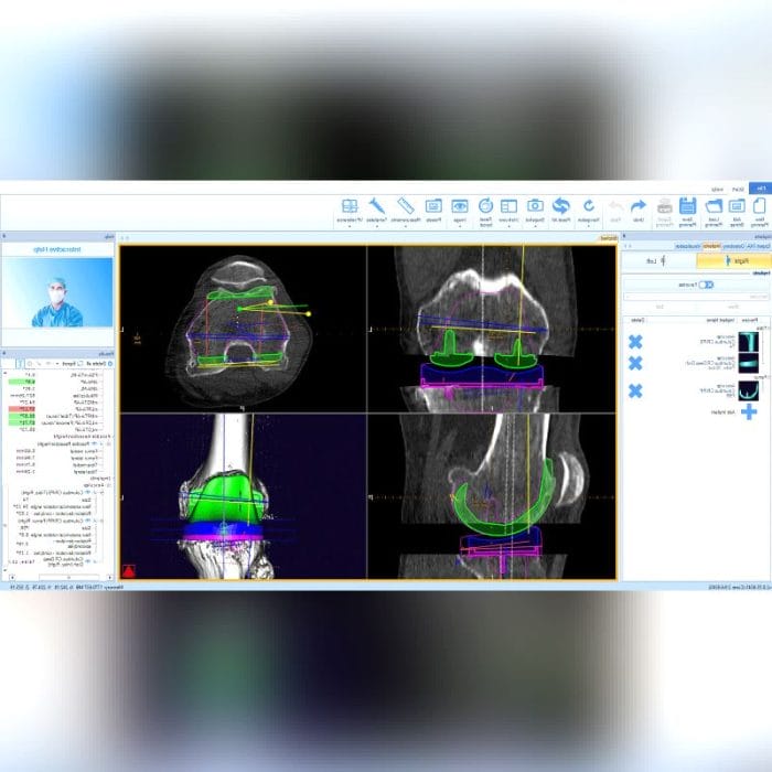 Orthopedic Software 3