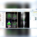 Orthopedic Software 4