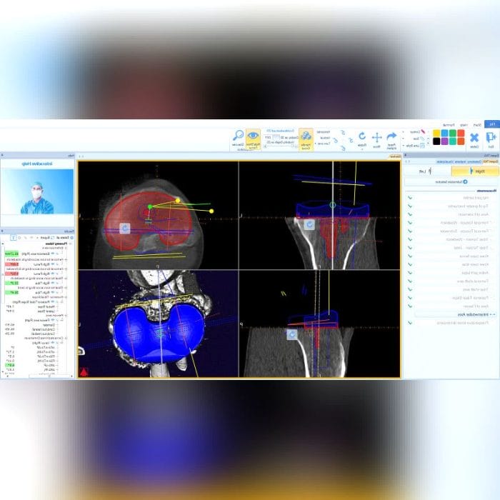 Orthopedic Software 5