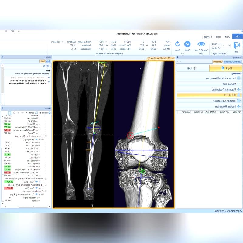 Orthopedic Software