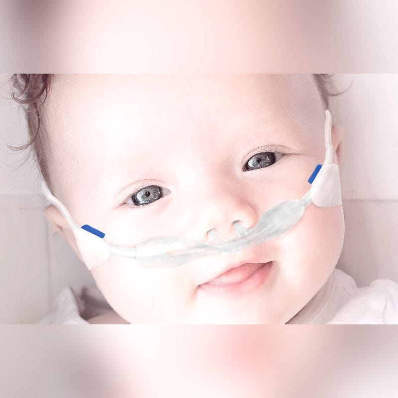 Oxygen Nasal Cannula