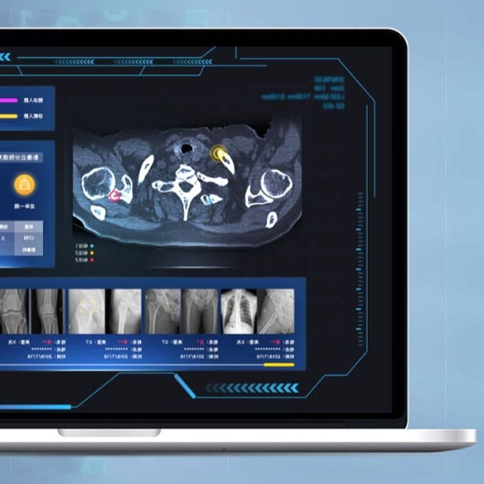 Pacs With Cloud Computing System