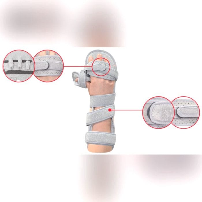 Palmar Resting Splint 3