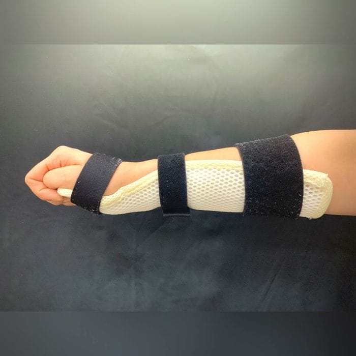 Palmar Resting Splint 2