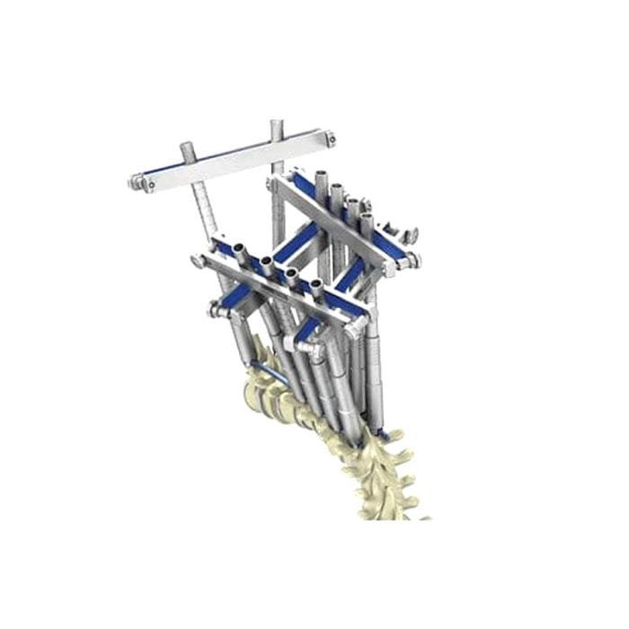 Pedicle Screw Positioning System