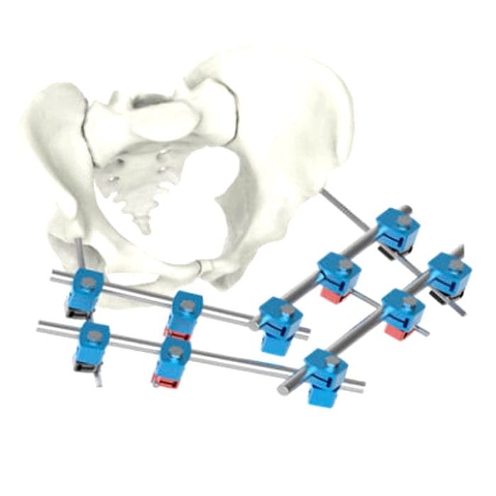 Pelvis External Fixation System