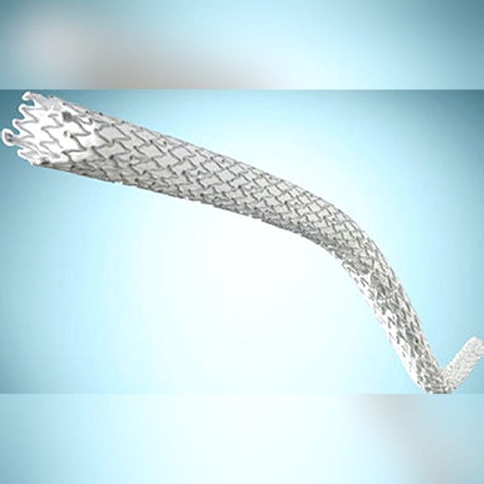 Peripheral Stent Graft