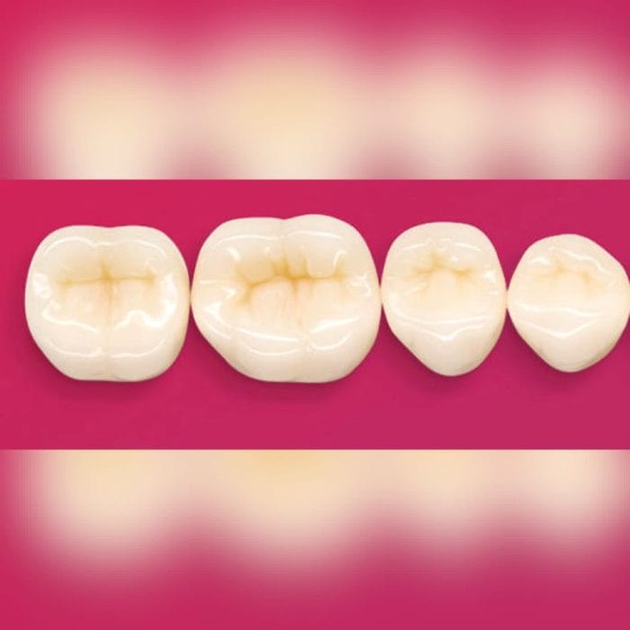 Pmma Dental Prosthesis 2