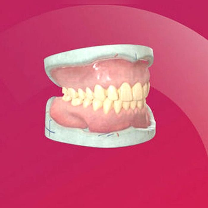 Pmma Dental Prosthesis 5