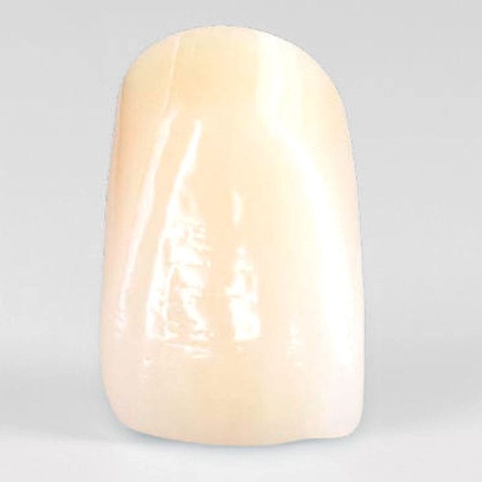 Pmma Dental Prosthesis