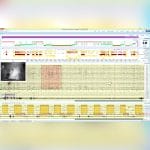 Polysomnograph With Eeg 2