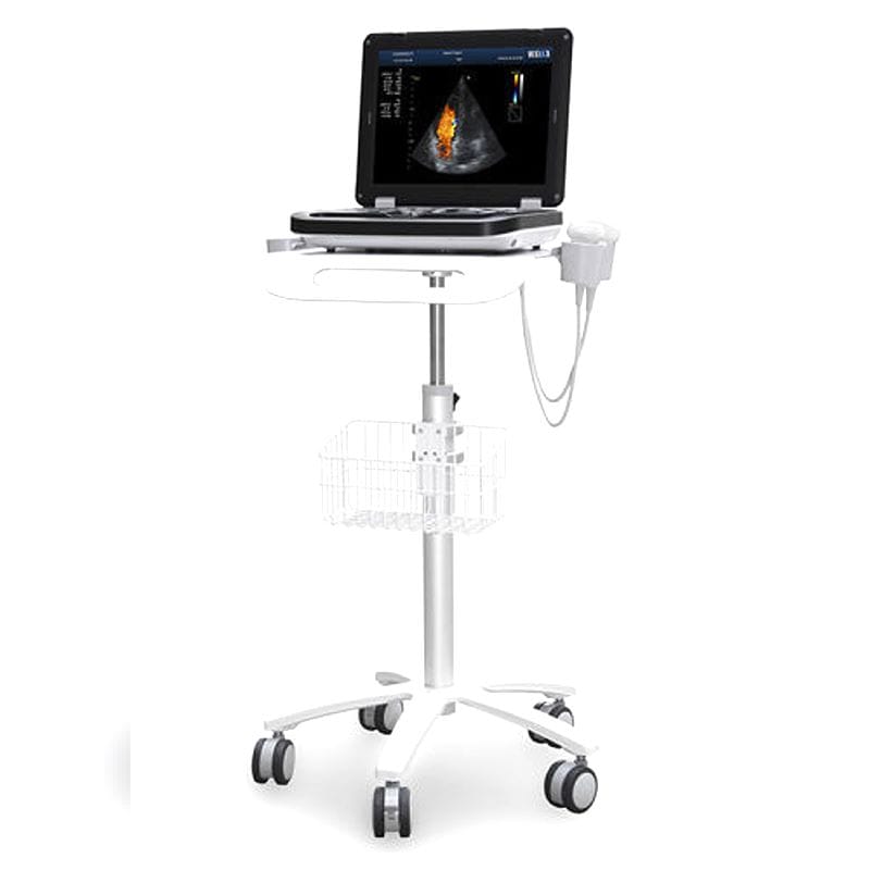 Portable Ultrasound System 1