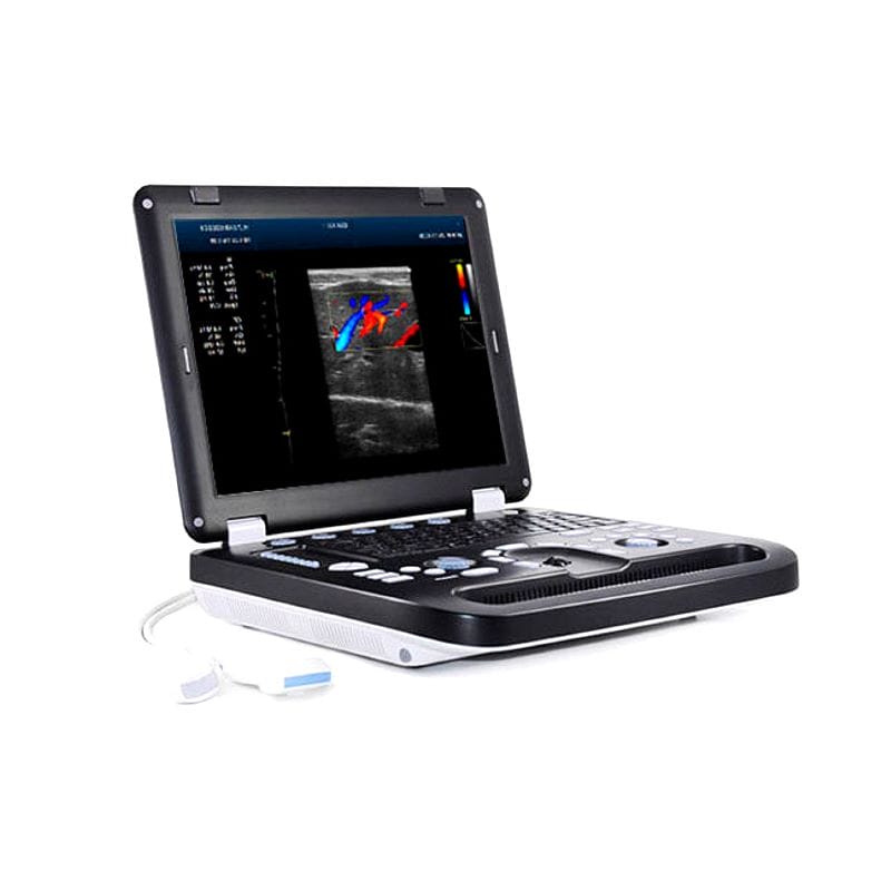 Portable Ultrasound System